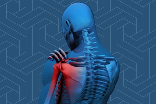 shoulder pain