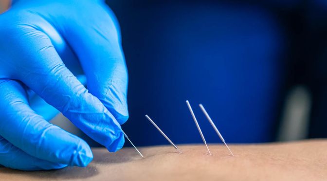 Advanced Dry Needling